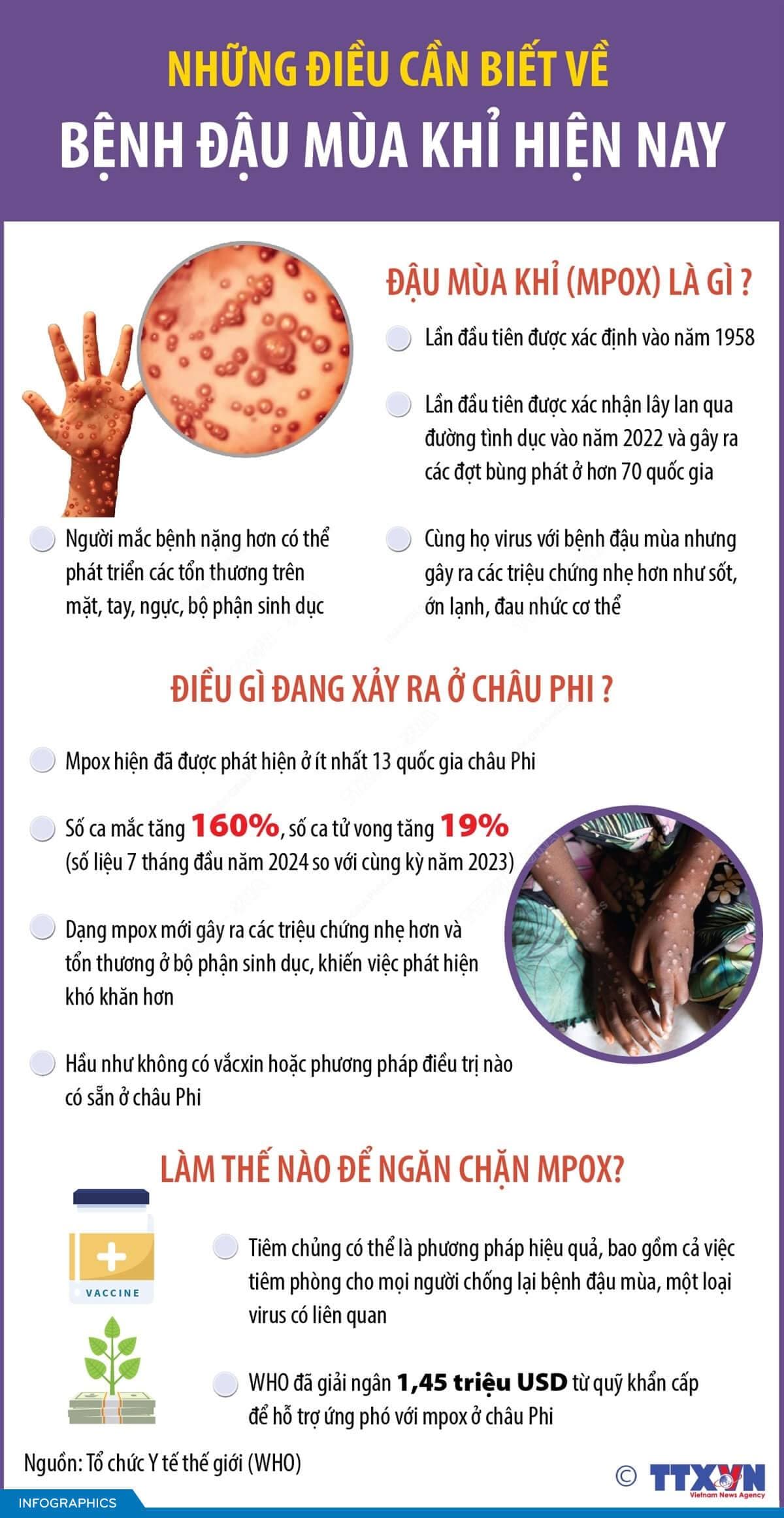 Những điều cần biết về bệnh đậu mùa khỉ hiện nay